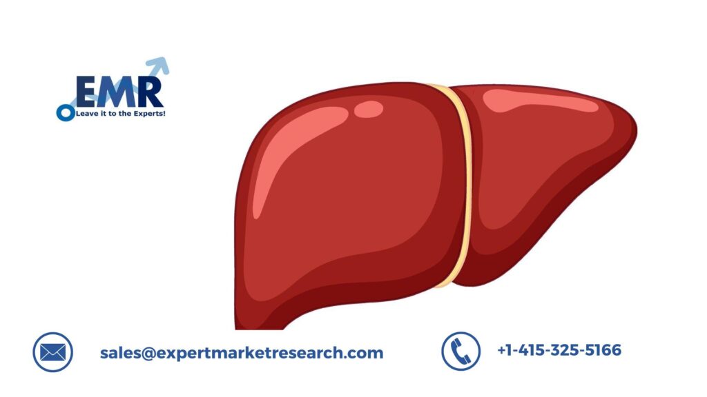 Non-Alcoholic Steatohepatitis (NASH) Treatment Market Growth