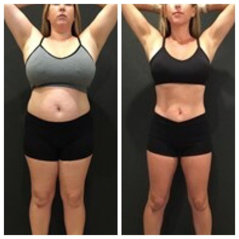 gastric balloon near me