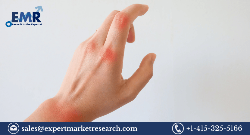 Psoriatic Arthritis Treatment Market