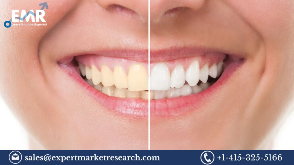 Cosmetic Dentistry Market