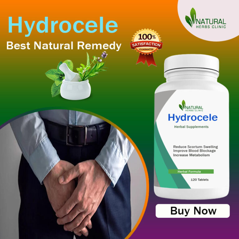 Home Remedies for Hydrocele
