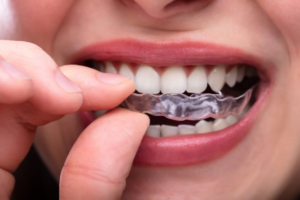 mouth guard for grinding teeth