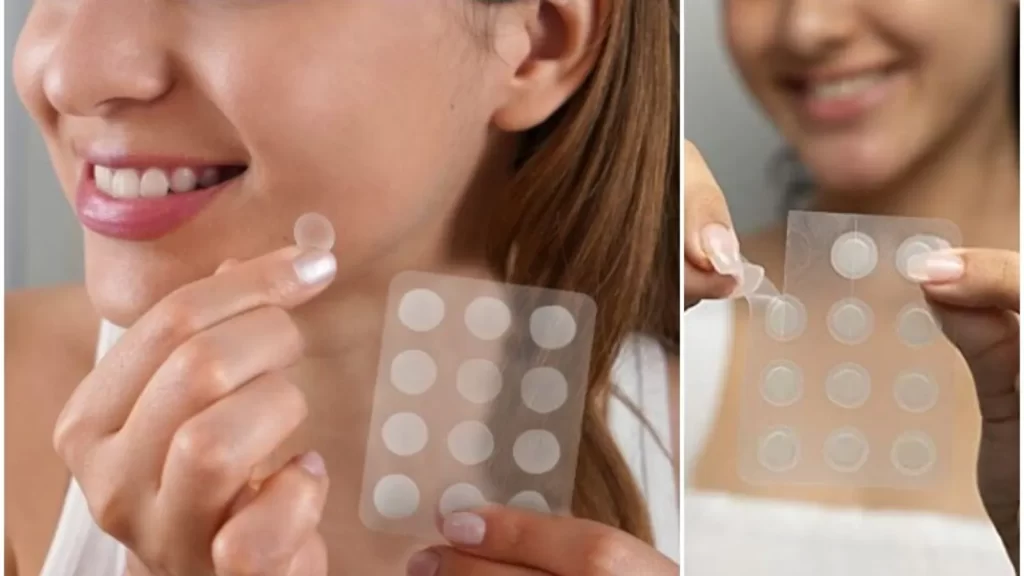 pimple patch before and after