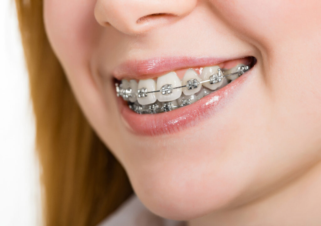 affordable orthodontist near me