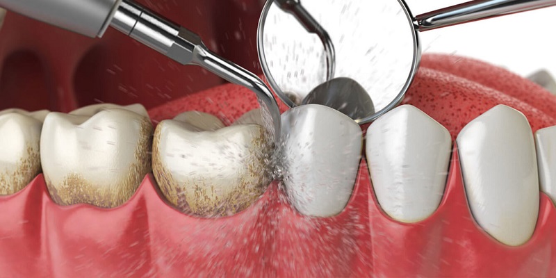dentist open near me