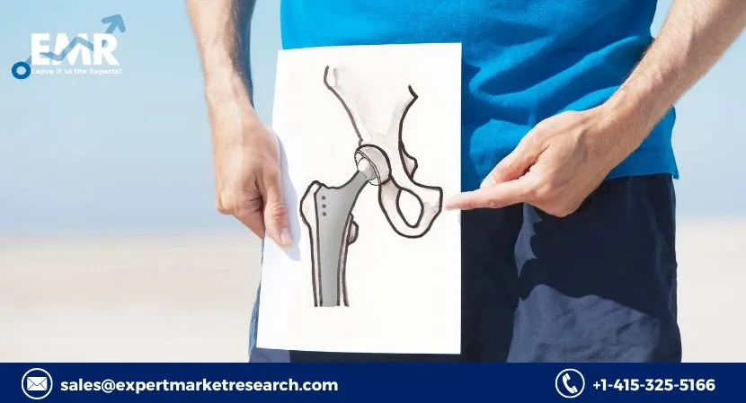 Hip Replacement Implants
