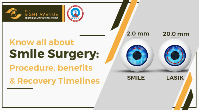 Smile Eye Surgery in Delhi