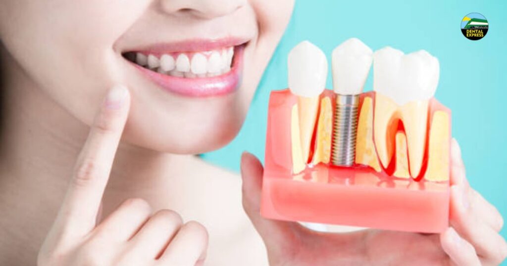 permanent teeth whitening
