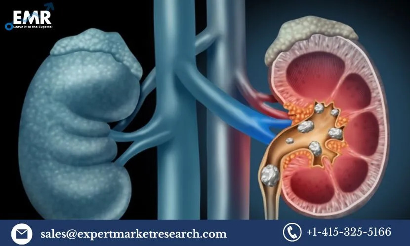 Primary Hyperoxaluria Treatment Market