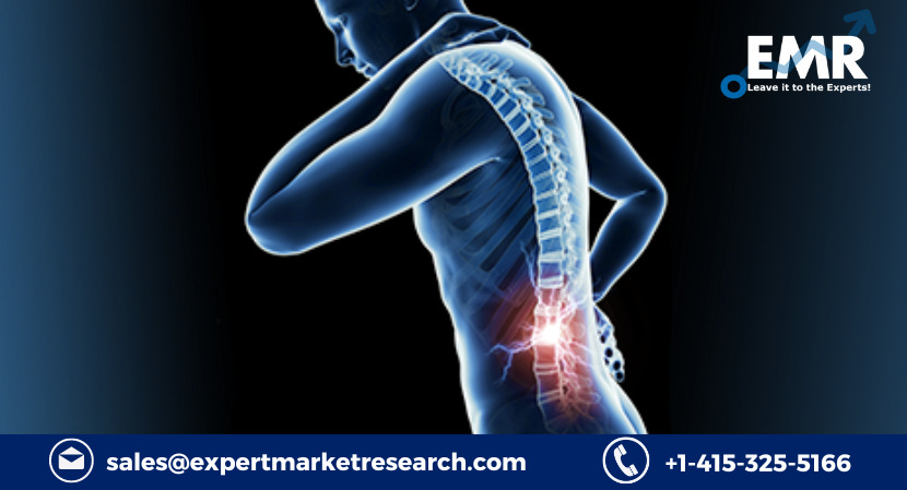 Spinal Cord Stimulation Market Size