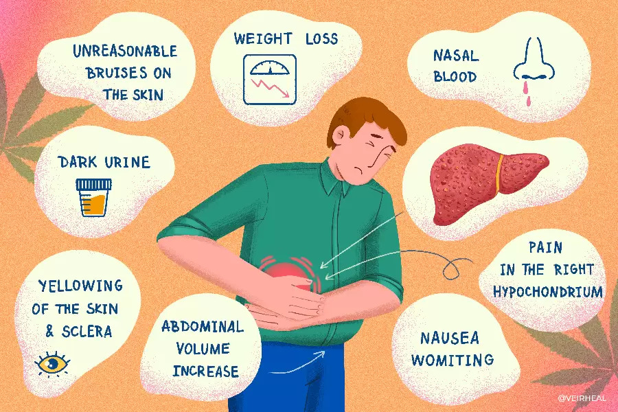 Can smoking lead to liver cirrhosis?