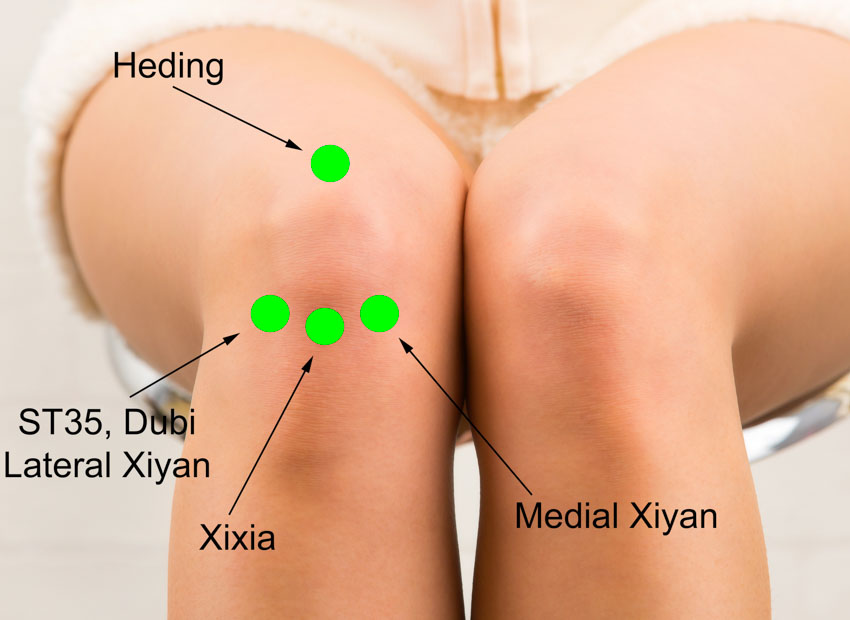 knee pain location chart