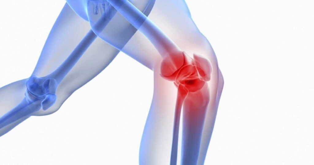 back knee pain location chart