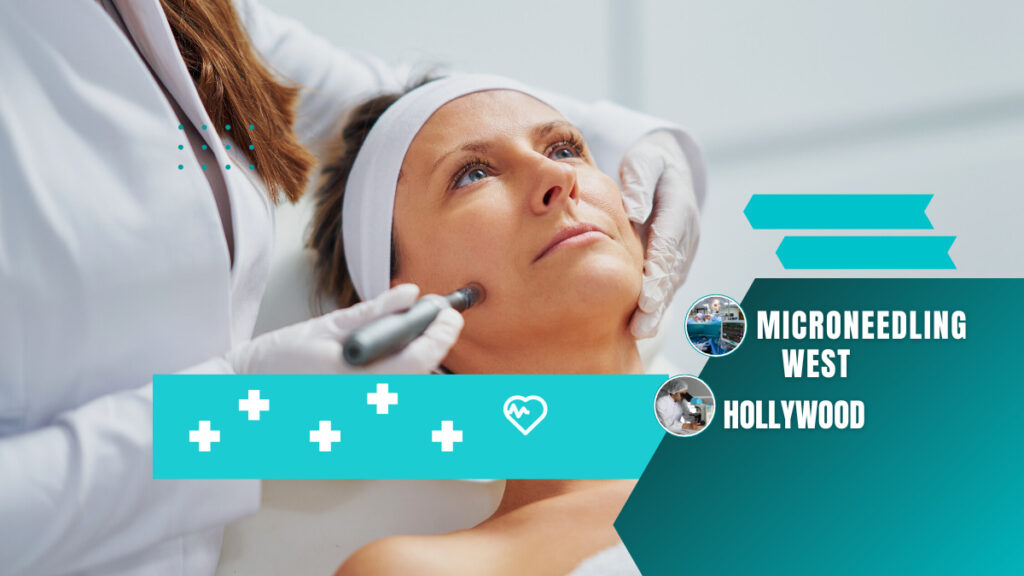 microneedling west hollywood