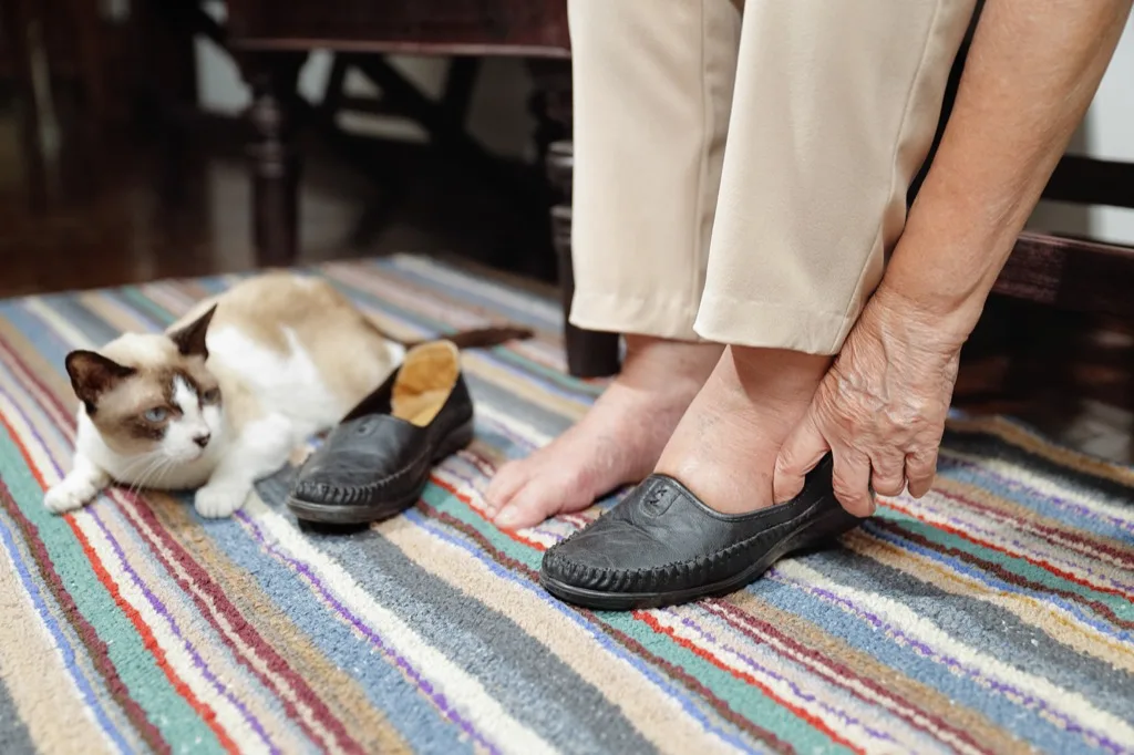 Shoes For Swollen Feet